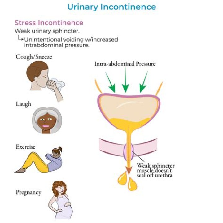Why does childbirth cause incontinence?